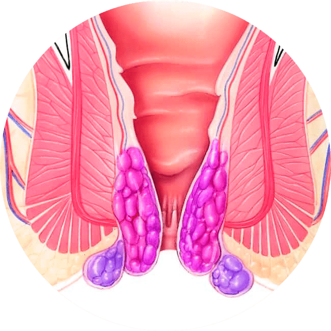 جيلاركس يخفف الأعراض من أول استعمال